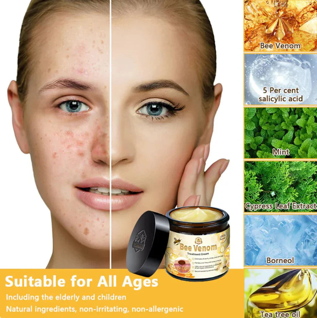 Bee Skin Elixir – Natural Bee Venom & Herbal Acne Cream for Clear Skin