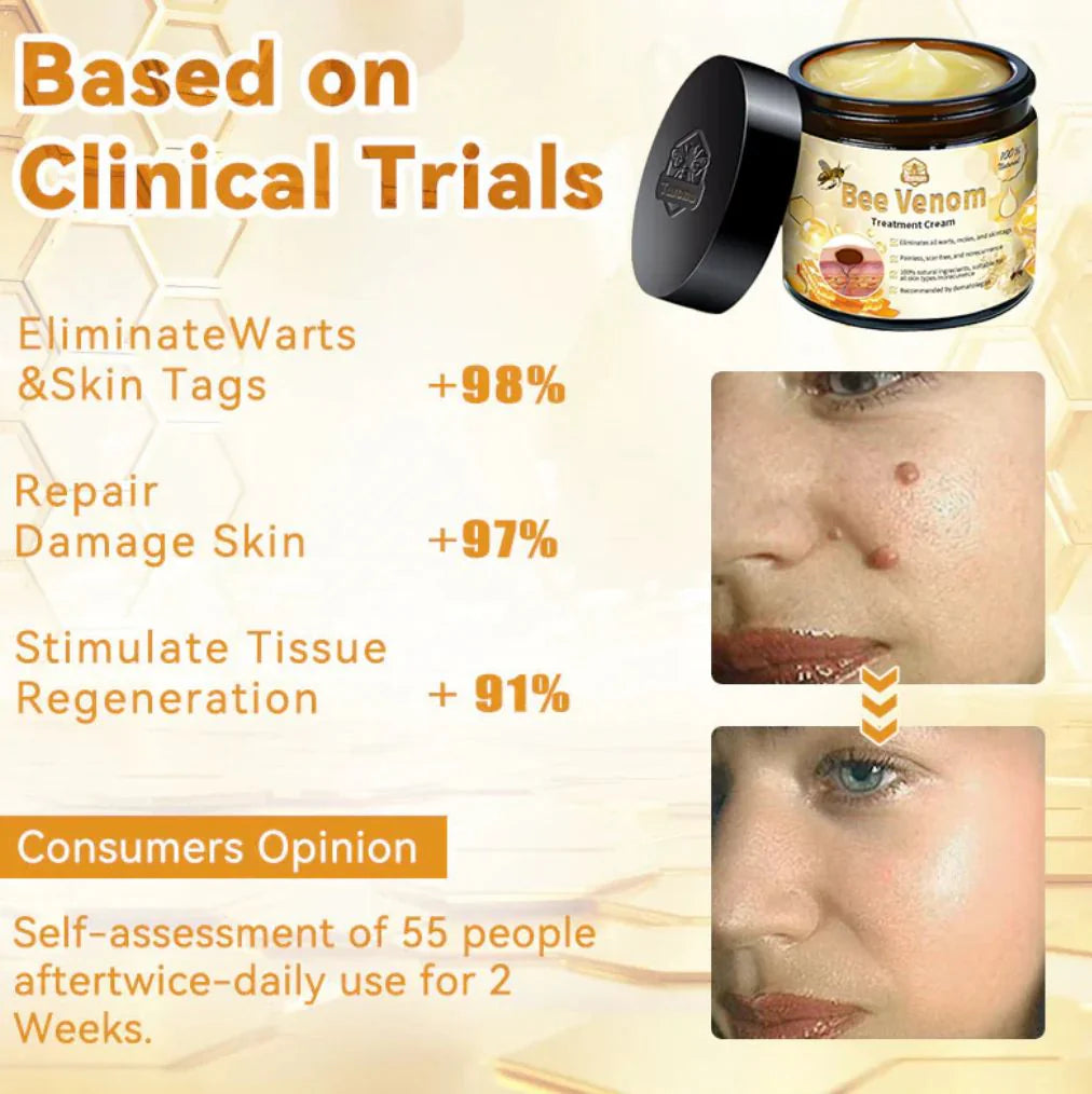 Bee Skin Elixir – Natural Bee Venom & Herbal Acne Cream for Clear Skin